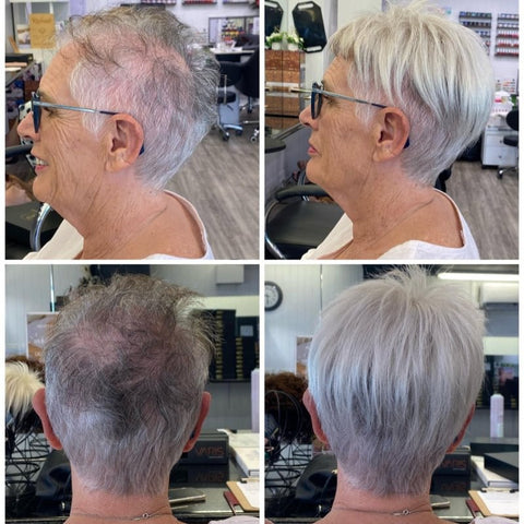 2025 Hot Sale Breathable&Natural Short Hair Topper For Women With Thinning Hair