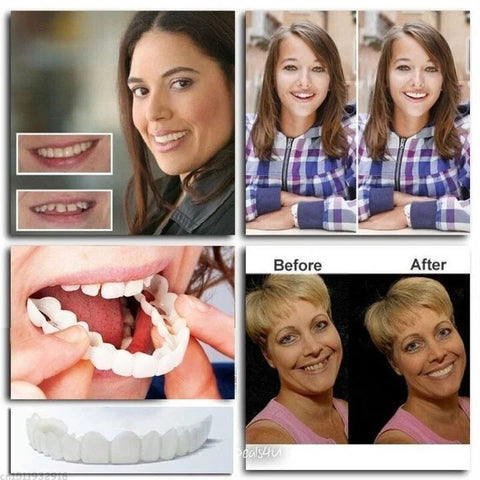 💝Last day discount-50%Off💝Latest👨‍⚕Adjustable Snap-On Dentures😁