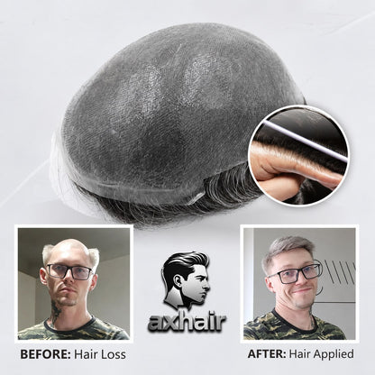 0.04–0.06mm V-Loop Ultra Thin Skin Hair System – Knotless Natural Hairline & Invisible Finish