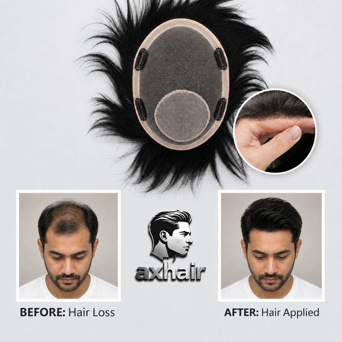 Viral Video Same Style Men’s Wig with Realistic Scalp, Natural-Looking Hairpiece for Southeast Asian Men（Buy One, Get One Free ）