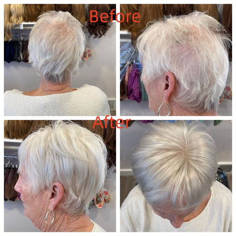 2025 Hot Sale Breathable&Natural Short Hair Topper For Women With Thinning Hair